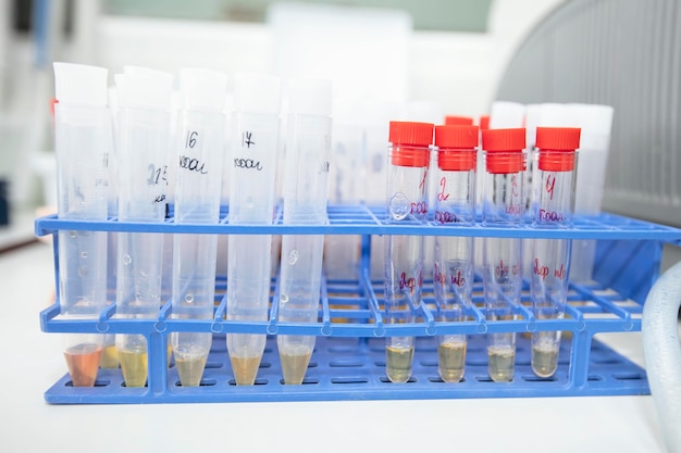 Medical test tubes with urine tests in a biochemical laboratory