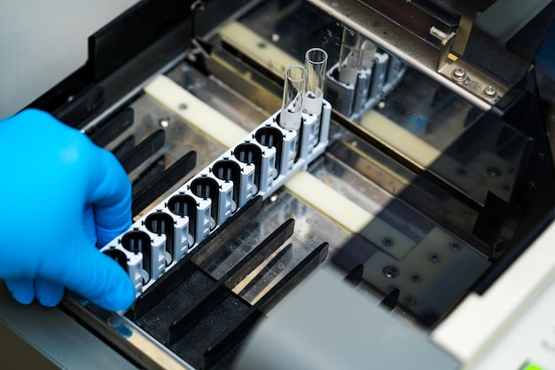 Medicine modern researchment of biological sample Laboratory analyzing test tubes Stock photo