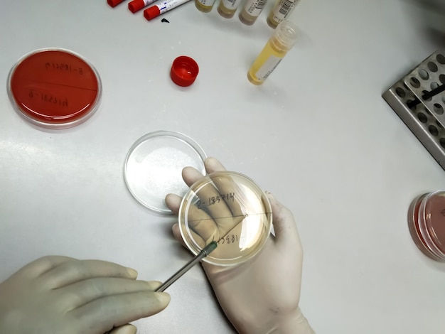 Microbiology, technician working with bacteria strains.