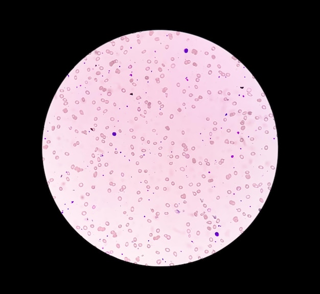 Microscopic view of hematology stained slide in laboratory