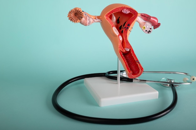 Model of female reproductive system and stethoscope lies on a blue background