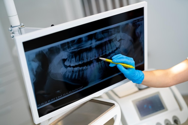 Modern digital radiology for stomatology Teeth dentistry x ray examination