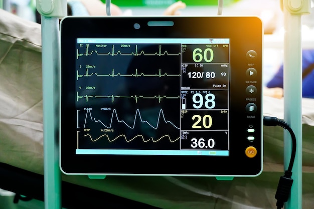 Photo modern vital sign monitor screen show patient data such as the waves of blood pressure blood oxygen saturation ecg heart rate close up