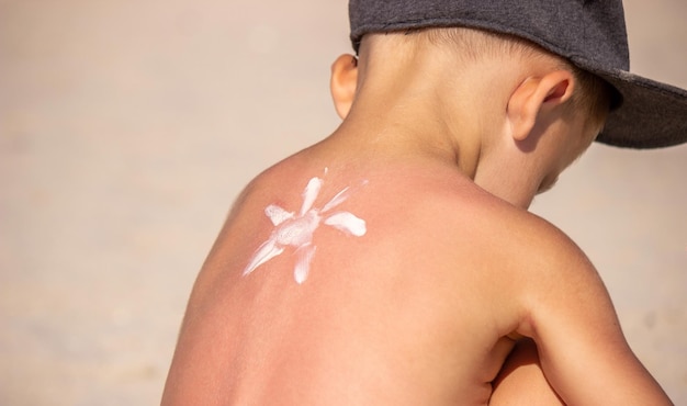 Mom applies suntan cream to her blue back