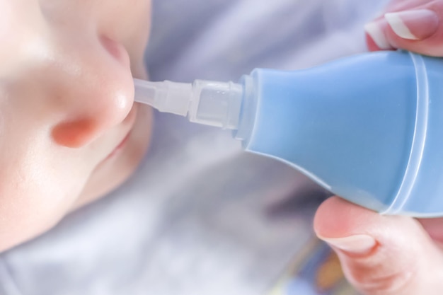 Mom is using a nasal aspirator to clean the newborn's nose