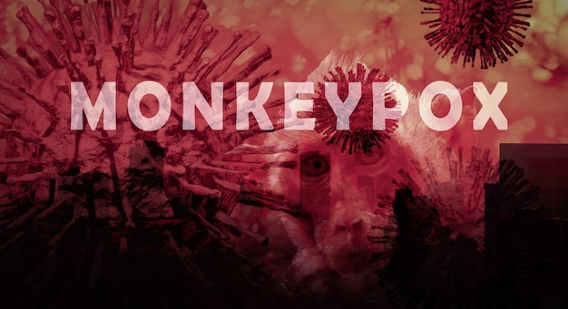 Monkeypox outbreak concept Monkeypox is caused by monkeypox virus Monkeypox is a viral zoonotic