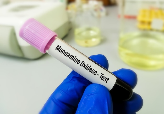 Monoamine oxidase test, a class of antidepressants drug.