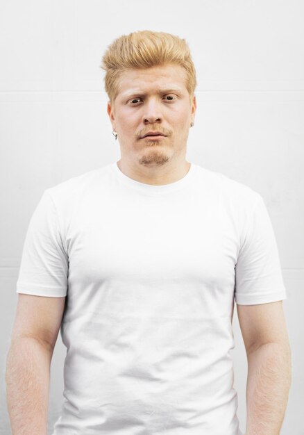 Photo monochrome portrait of an albino latino man in white clothing against a white background