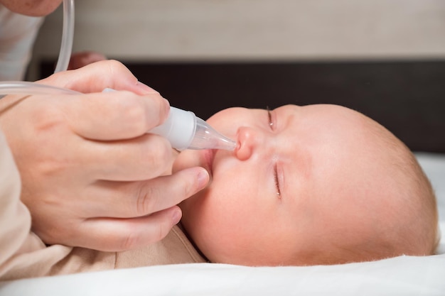 Mother cleans nose of little girl from snot using aspirator