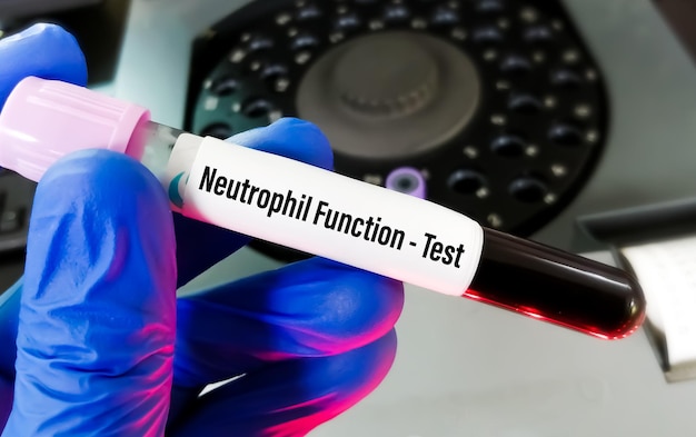 Neutrophil Function Test or Dihydrorhodamine (DHR) test to diagnose Chronic granulomatous disease.