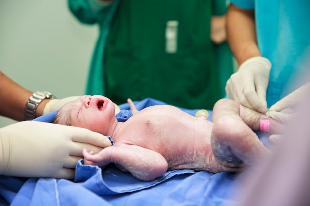 Newborn baby in labor room