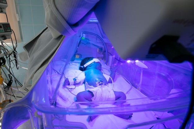 Newborn child baby having a treatment for jaundice under ultraviolet light in incubator