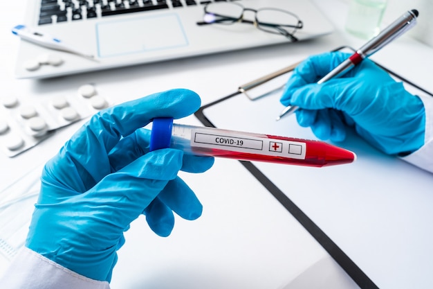 Nurse holding a positive blood test result for the new rapidly spreading Coronavirus