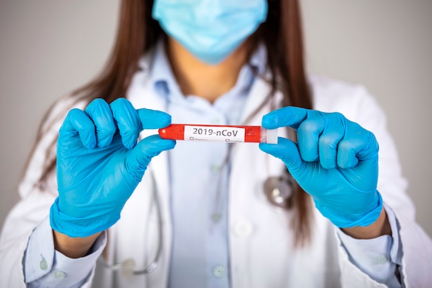 Nurse holding test tube with blood for 2019-nCoV analyzing. Novel Chinese Coronavirus blood test Concept. Healthcare to aid recovery from COVID-19.