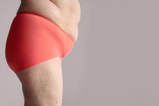 Obese woman with thick buttocks, obese female body