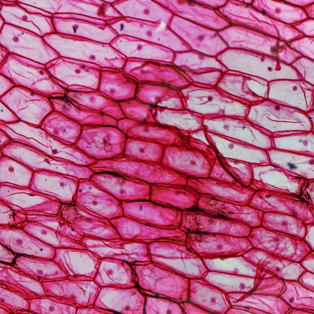 Onion epidermus micrograph