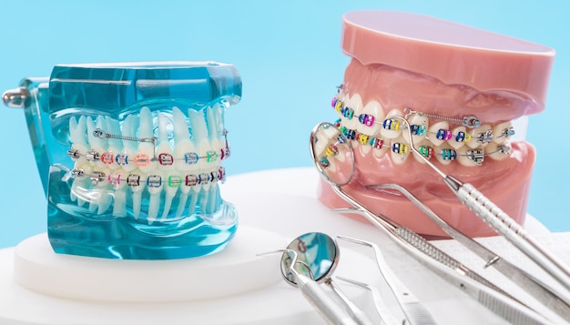 Orthodontic model and dentist tool - demonstration teeth model of varities of orthodontic bracket or brace