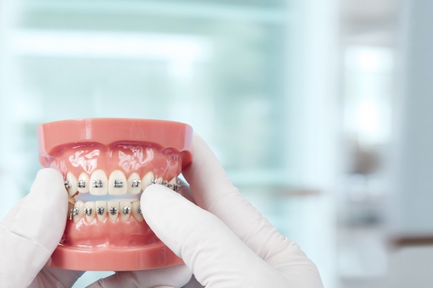 Orthodontic model and dentist tool - demonstration teeth model of varities of orthodontic bracket or brace