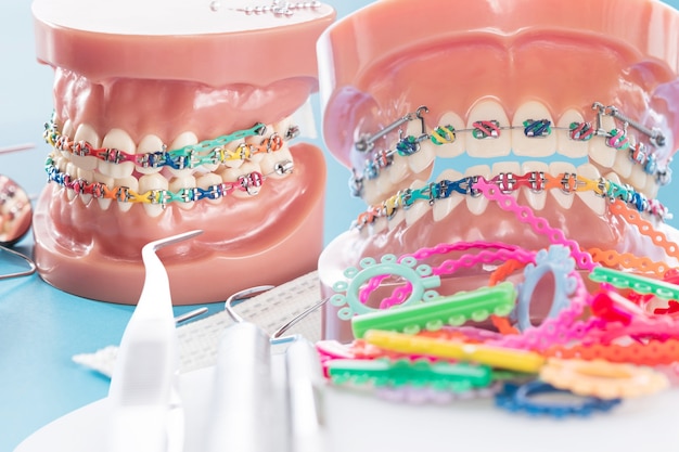 Orthodontic model and dentist tool - demonstration teeth model of varities of orthodontic bracket or brace