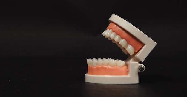 Orthodontic model of teeth isolated on black background.For dental care and no people