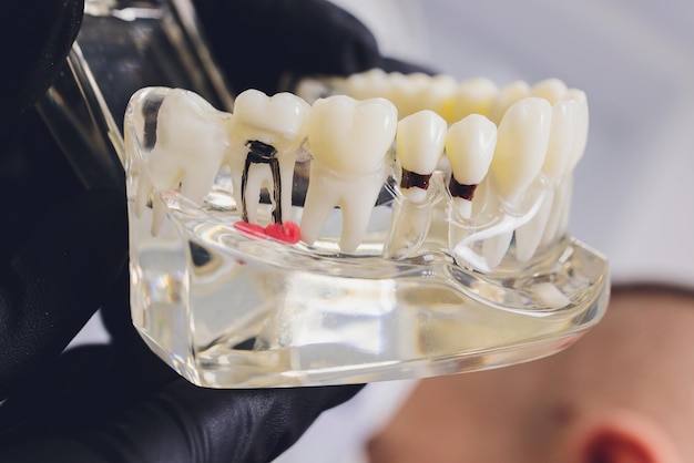 Orthodontist holds jaw in his hands for training Package with capillaries roots pins