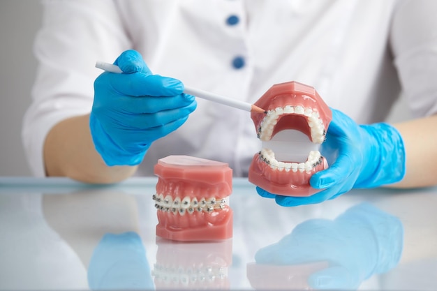 Orthodontist showing model of human jaw with wire braces and aligners explaining the difference