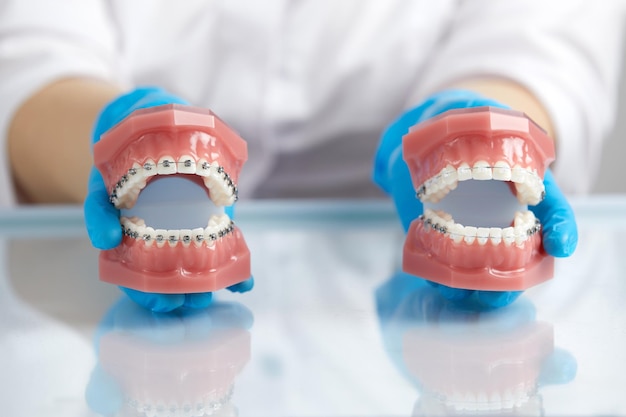 Orthodontist showing model of human jaw with wire braces and aligners explaining the difference