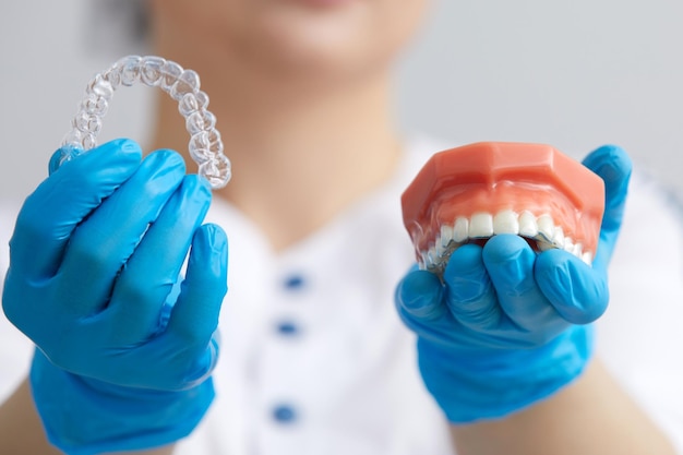 Orthodontist showing the system of aligners on artificial jaws