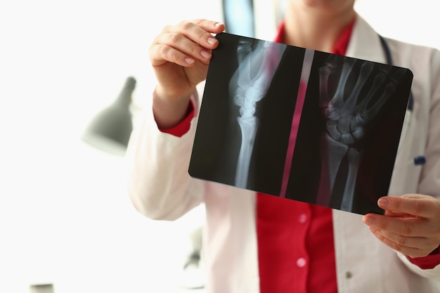 Orthopedist examines xray of patient hand in clinic