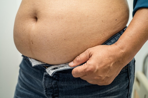 Overweight Asian woman show fat belly at office