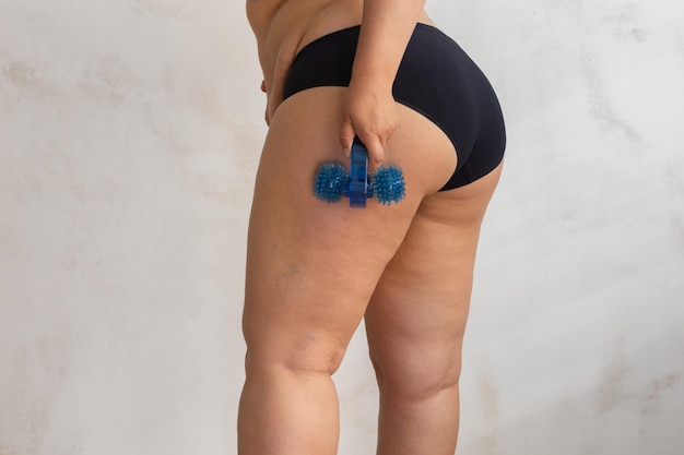 Overweight fat woman in black lingerie apply self tool massage with blue plastic roller for cellulite hips Rejuvenating