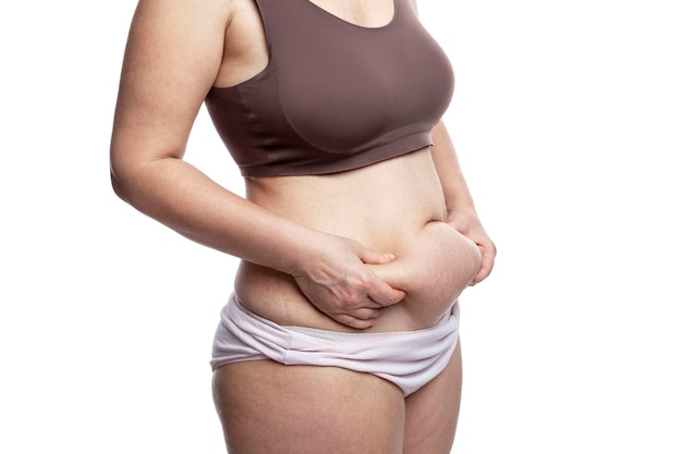 Overweight woman in lingerie touches belly fat with stretch marks Obesity and disease Isolated on white background