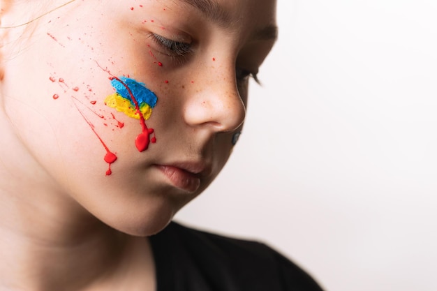 The paint is yellow blue like the ruler of Ukraine and red like the blood on the child's face