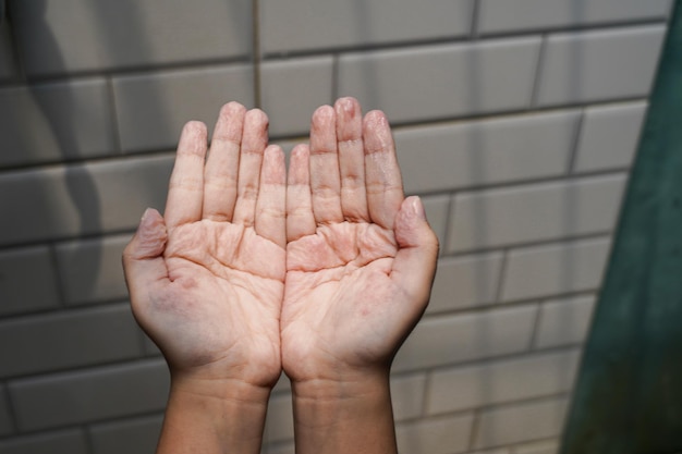 palms, fingers, hands wrinkled from too long exposure to water