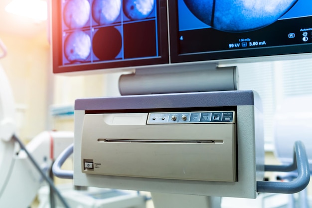 Part of surgery monitor at clinic while operating process Special technic Advanced modern technologies Hospital Closeup