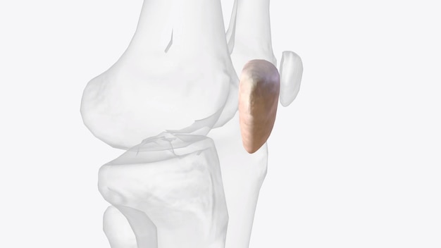 Photo the patella is the largest sesamoid bone in the human