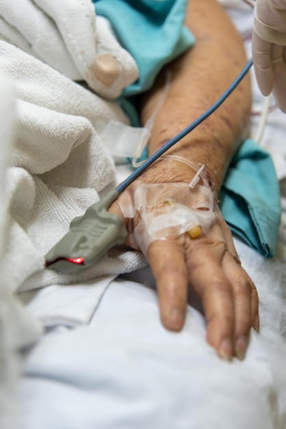 Patient in the hospital with pulse gauge on finger