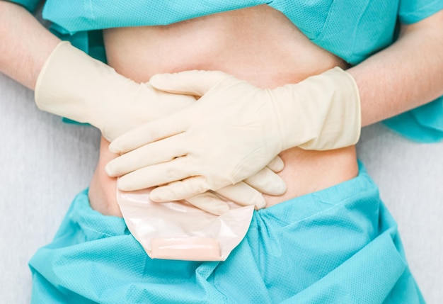 A patient in pajamas with an open abdomen presses the colostomy bag with hands in sterile gloves