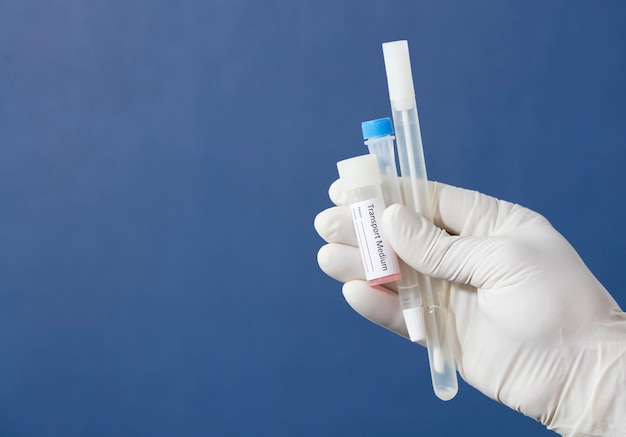 Photo pcr analysis kit  buccal swab transport medium in the hands of a doctor or curse blue background