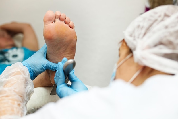 Photo peeling of the heel with a pedicure the doctor treats the skin of the foot