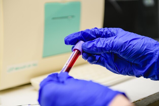 A person in blue gloves holds a test tube with a blood sample in it.