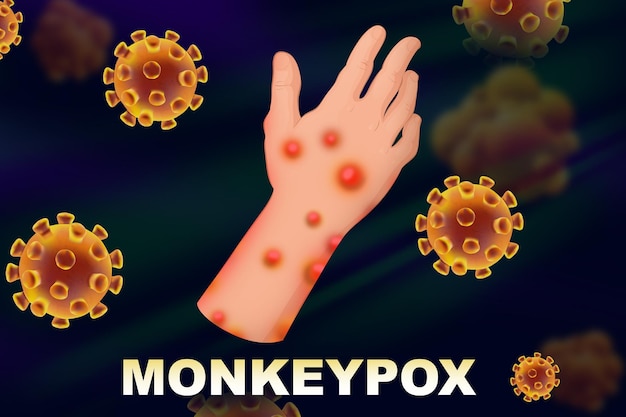 Photo person diseased by monkeypox virus illustration dangerous disease