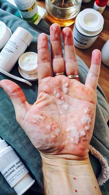 a person with sugar on their hand and a bottle of cream