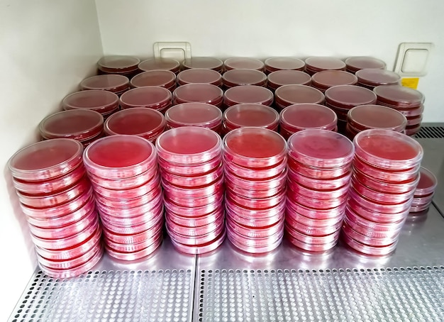 Petri dishes isolated on safety cabinet, which is for bacterial culture in microbiology department.