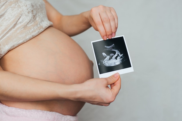 Photo of a pregnant ultrasound in the hands of a pregnant girl