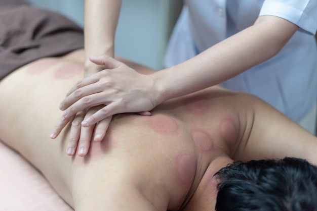 The physiotherapist is checking for abnormalities of the body after cupping treatment.