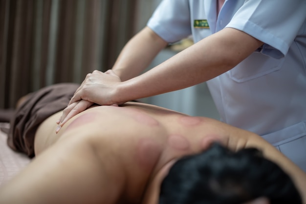 The physiotherapist is checking for abnormalities of the body after cupping treatment.