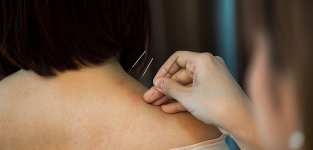 The physiotherapist is doing acupuncture on young women.