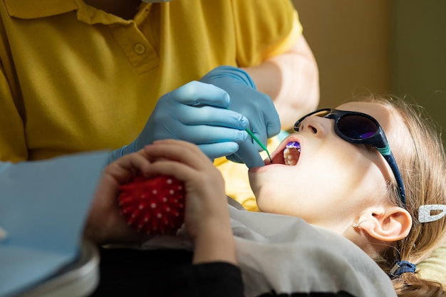 Plaque on teeth colored pink and purpleBaby mouthwash Dental visit Teeth before and after brushing and whitening in one photo Preventive examination of children at the dentist