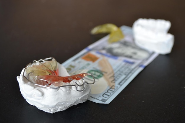 Plaster cast of teeth and dental plate on the background of money